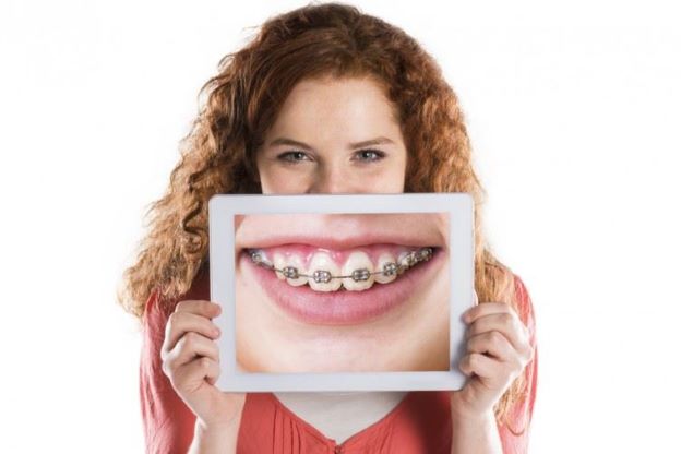 teeth straightening benefits